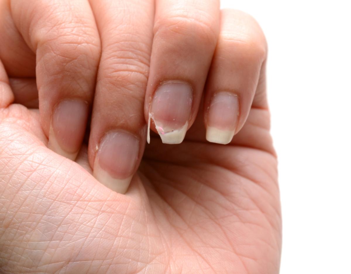 7 Days Nail Growth and Strengthening Serum, Nail Repair Essence Nails  Treatment | eBay