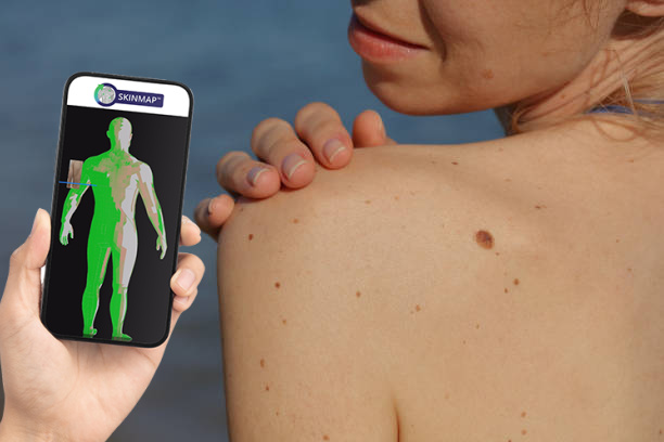 We Are Thrilled to Introduce Skinmap Total Body Photography